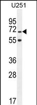 TNIP1 Antibody in Western Blot (WB)