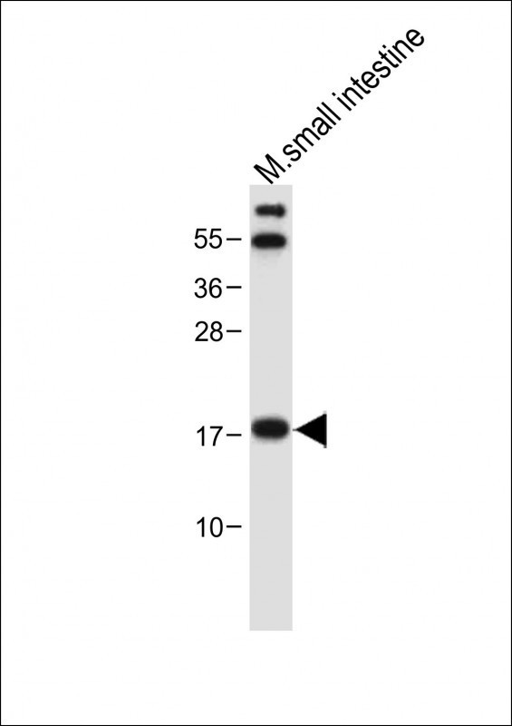 NUDT15 Antibody in Western Blot (WB)