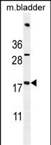 SDHAF3 Antibody in Western Blot (WB)