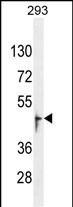 OR13J1 Antibody in Western Blot (WB)