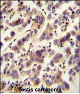 OR1J4 Antibody in Immunohistochemistry (Paraffin) (IHC (P))