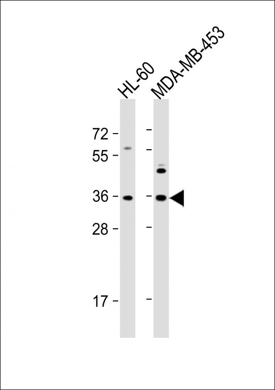 OR1J4 Antibody in Western Blot (WB)