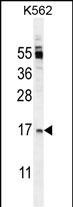 OX40L Antibody in Western Blot (WB)