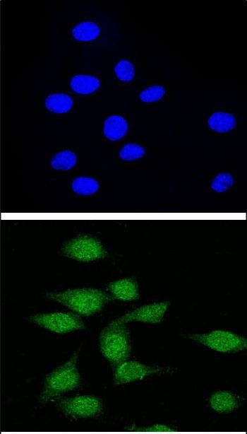 AIRE Antibody in Immunocytochemistry (ICC/IF)