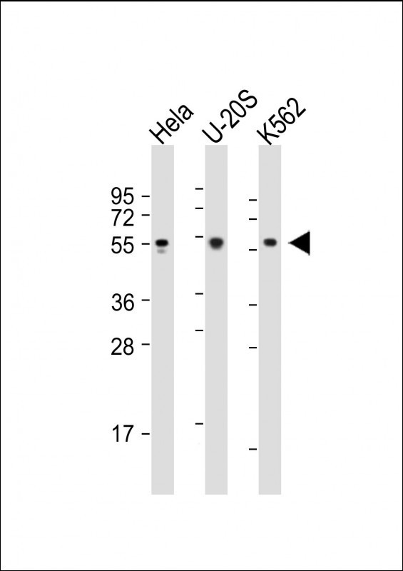 AIRE Antibody in Western Blot (WB)