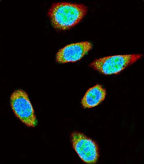 SUMO1 Antibody in Immunocytochemistry (ICC/IF)