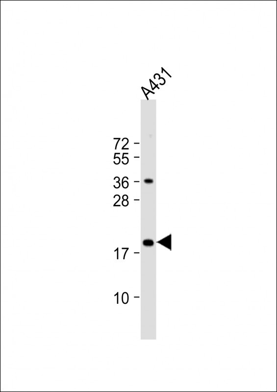 SUMO1 Antibody in Western Blot (WB)