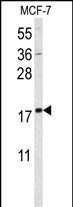 SUMO1 Antibody in Western Blot (WB)