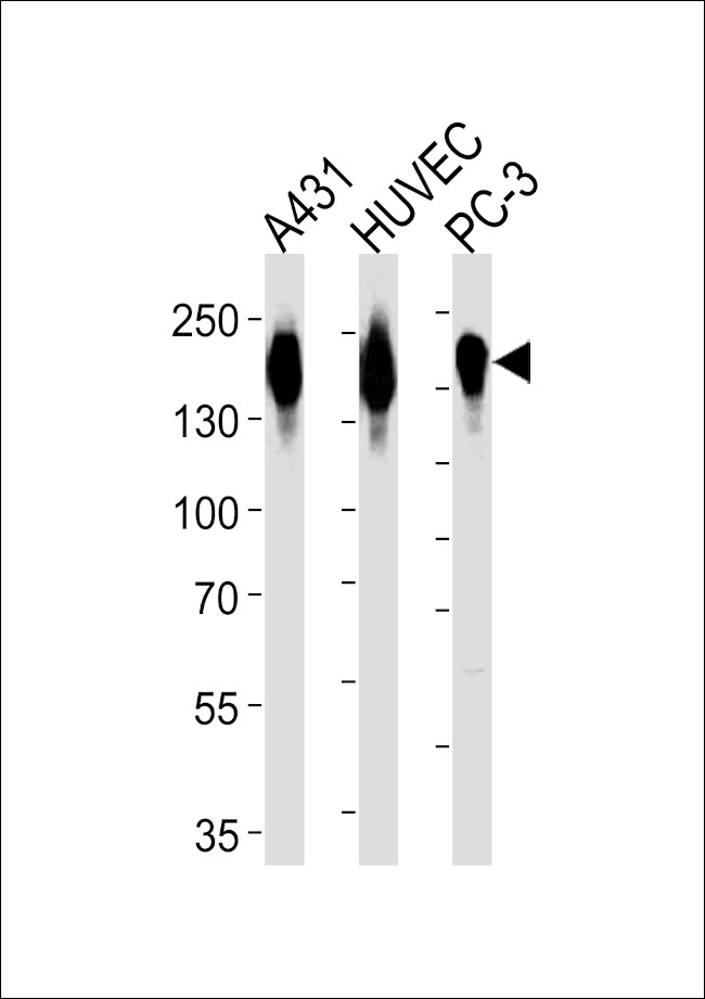 EGFR Antibody in Western Blot (WB)