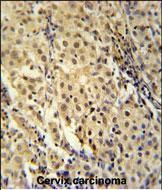 FOXC2 Antibody in Immunohistochemistry (Paraffin) (IHC (P))