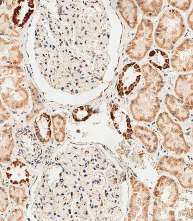 GLS2 Antibody in Immunohistochemistry (Paraffin) (IHC (P))