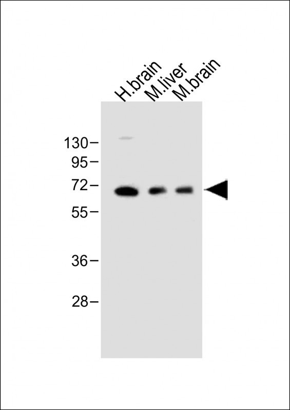 GLS2 Antibody in Western Blot (WB)