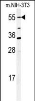 CYP26A1 Antibody in Western Blot (WB)