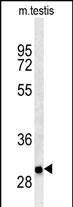 ITGB1BP3 Antibody in Western Blot (WB)