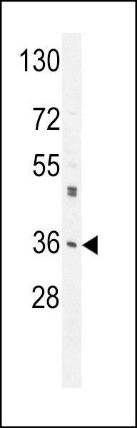 M6PR Antibody in Western Blot (WB)