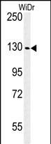 IGF1R alpha Antibody in Western Blot (WB)