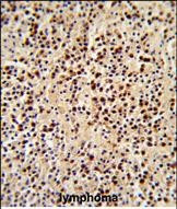 LCK Antibody in Immunohistochemistry (Paraffin) (IHC (P))