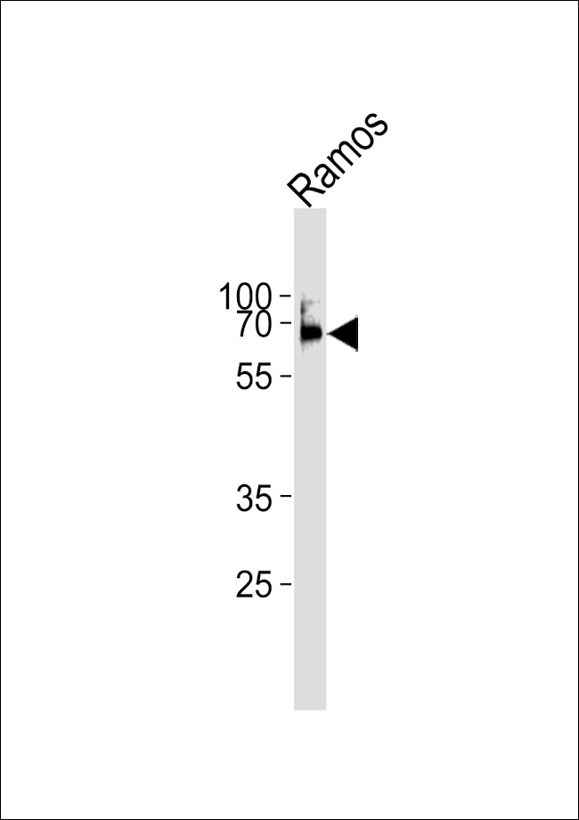 LCK Antibody in Western Blot (WB)