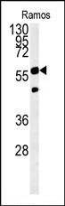 PHGDH Antibody in Western Blot (WB)