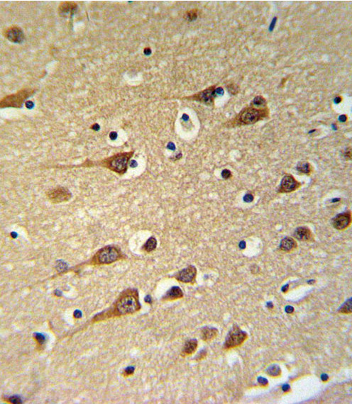 GOT1 Antibody in Immunohistochemistry (Paraffin) (IHC (P))