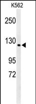 CTC1 Antibody in Western Blot (WB)