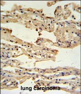 IFITM2 Antibody in Immunohistochemistry (Paraffin) (IHC (P))