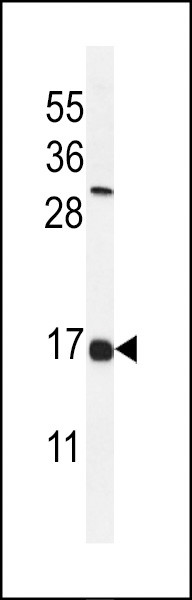 IFITM2 Antibody in Western Blot (WB)