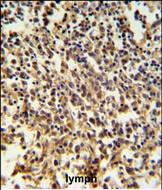 RNaseH2B Antibody in Immunohistochemistry (Paraffin) (IHC (P))