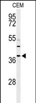 RNaseH2B Antibody in Western Blot (WB)