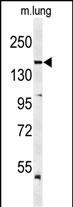 VEGF Receptor 2 Antibody in Western Blot (WB)