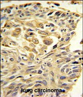 ZO-1 Antibody in Immunohistochemistry (Paraffin) (IHC (P))