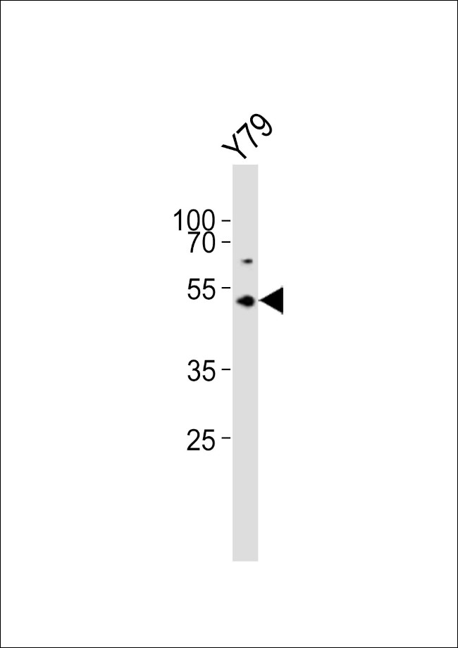 ASMT Antibody in Western Blot (WB)