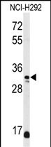 DDO Antibody in Western Blot (WB)