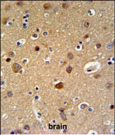 TELO2 Antibody in Immunohistochemistry (Paraffin) (IHC (P))