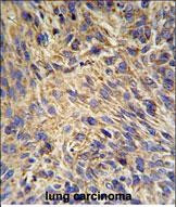 GRP94 Antibody in Immunohistochemistry (Paraffin) (IHC (P))