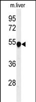 PAH Antibody in Western Blot (WB)