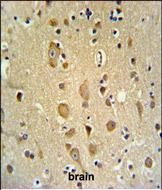 APITD1 Antibody in Immunohistochemistry (Paraffin) (IHC (P))