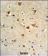 CD64 Antibody in Immunohistochemistry (Paraffin) (IHC (P))