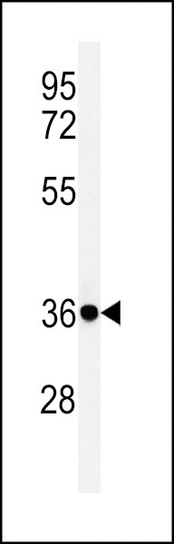 CD64 Antibody in Western Blot (WB)