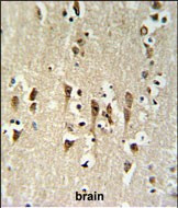 KCTD1 Antibody in Immunohistochemistry (Paraffin) (IHC (P))