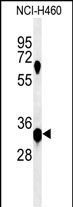 KCTD1 Antibody in Western Blot (WB)