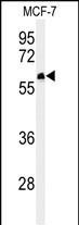 FAM20A Antibody in Western Blot (WB)