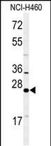 RAB27B Antibody in Western Blot (WB)