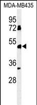 BTNL8 Antibody in Western Blot (WB)