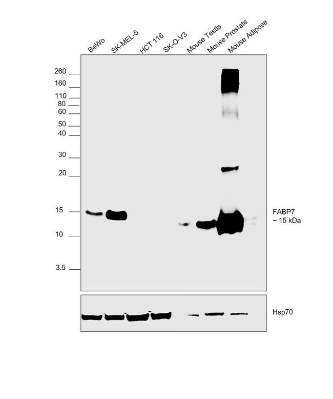 FABP7 Antibody in Western Blot (WB)