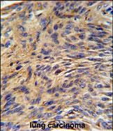 GRP78 Antibody in Immunohistochemistry (Paraffin) (IHC (P))