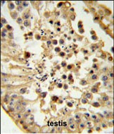 H3K9me2 Antibody in Immunohistochemistry (Paraffin) (IHC (P))