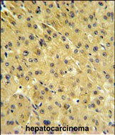 PSMAL Antibody in Immunohistochemistry (Paraffin) (IHC (P))