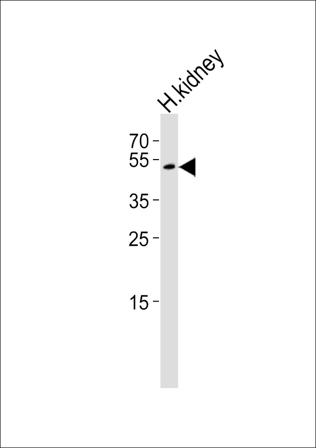 PSMAL Antibody in Western Blot (WB)