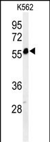 PSMAL Antibody in Western Blot (WB)